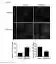 Fig. 08 - COMPOSITION USING METFORMIN FOR PREVENTING OR TREATING IMMUNE DISEASES INCLUDING LUPUS