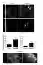 Fig. 10 - COMPOSITION USING METFORMIN FOR PREVENTING OR TREATING IMMUNE DISEASES INCLUDING LUPUS