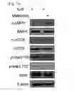 Fig. 13 - COMPOSITION USING METFORMIN FOR PREVENTING OR TREATING IMMUNE DISEASES INCLUDING LUPUS