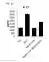Fig. 16 - COMPOSITION USING METFORMIN FOR PREVENTING OR TREATING IMMUNE DISEASES INCLUDING LUPUS