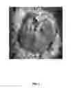 Fig. 02 - Methods and compositions for the treatment of ischemic injury to tissue using therapeutic hypothermia