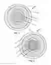 Fig. 02 - Protective Supplement Configuration