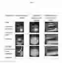 Fig. 02 - INJECTABLE STERILE AQUEOUS FORMULATION BASED ON CROSSLINKED HYALURONIC ACID AND ON HYDROXYAPATITE, FOR THERAPEUTIC USE