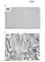 Fig. 03 - Formulations involving solvent/detergent-treated plasma (S/D plasma) and uses thereof