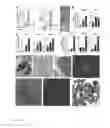 Fig. 06 - METHODS TO ISOLATE HUMAN MESENCHYMAL STEM CELLS