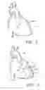 Fig. 02 - Method and system for treatment of cardiovascular disorders