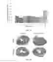 Fig. 05 - Methods for treating cardiac conditions