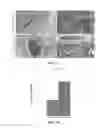 Fig. 08 - Methods for treating cardiac conditions