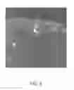 Fig. 06 - AAV vectors targeted to oligodendrocytes