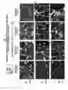 Fig. 03 - Compositions, formulations and methods of treating preeclampsia-type disorders of pregnancy