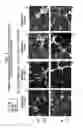 Fig. 04 - Compositions, formulations and methods of treating preeclampsia-type disorders of pregnancy