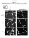 Fig. 10 - Compositions, formulations and methods of treating preeclampsia-type disorders of pregnancy