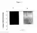 Fig. 05 - EXENDINS TO LOWER CHOLESTEROL AND TRIGLYCERIDES