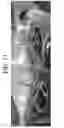 Fig. 14 - Nonspecific immunostimulator composition, method of preparation the same, and its use