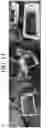 Fig. 15 - Nonspecific immunostimulator composition, method of preparation the same, and its use