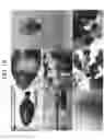 Fig. 17 - Nonspecific immunostimulator composition, method of preparation the same, and its use