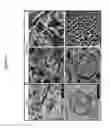 Fig. 06 - Organ/tissue decellularization, framework maintenance and recellularization