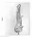 Fig. 13 - Organ/tissue decellularization, framework maintenance and recellularization