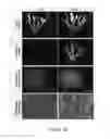 Fig. 19 - Organ/tissue decellularization, framework maintenance and recellularization