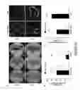 Fig. 23 - Organ/tissue decellularization, framework maintenance and recellularization