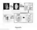 Fig. 24 - Organ/tissue decellularization, framework maintenance and recellularization