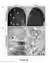 Fig. 27 - Organ/tissue decellularization, framework maintenance and recellularization