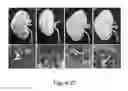 Fig. 28 - Organ/tissue decellularization, framework maintenance and recellularization