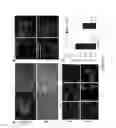 Fig. 35 - Organ/tissue decellularization, framework maintenance and recellularization