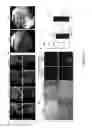 Fig. 37 - Organ/tissue decellularization, framework maintenance and recellularization