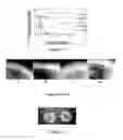 Fig. 09 - Composite tissue-engineered intervertebral disc with self-assembled annular alignment