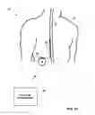 Fig. 04 - Posture state display on medical device user interface