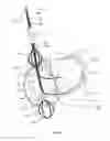 Fig. 08 - Cardiac Access Catheter, System, and Method