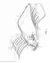 Fig. 02 - Self-catheterization assistance apparatus