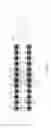 Fig. 02 - GUIDE WIRE
