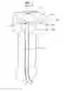Fig. 02 - Stretch valve balloon catheter and methods for producing and using same