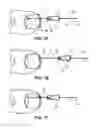 Fig. 02 - Method of treating infections, diseases or disorders of nail unit