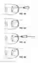 Fig. 06 - Method of treating infections, diseases or disorders of nail unit