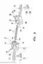 Fig. 03 - Device for preparing an implanted medical apparatus for extraction