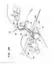 Fig. 05 - Device for preparing an implanted medical apparatus for extraction