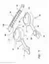 Fig. 08 - Device for preparing an implanted medical apparatus for extraction