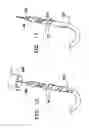 Fig. 10 - Device for preparing an implanted medical apparatus for extraction