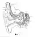 Fig. 02 - Temporal coding for hearing implants