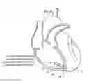 Fig. 01 - Automatic capture verification within leadless implantable medical devices