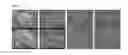 Fig. 07 - Supported catalyst, method for preparing same, secondary structure of carbon nanostructure manufactured using same