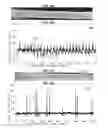 Fig. 23 - Punch card programmable microfluidics