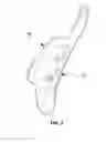 Fig. 08 - Apparatus of side bolster for guiding developing direction of side airbag