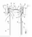 Fig. 02 - CABLE SYSTEM FOR A VEHICLE PARKING BRAKE