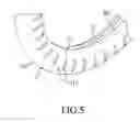 Fig. 06 - STEERING WHEEL COVER