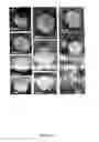 Fig. 16 - Antibodies Directed Against Hepatitis C Virus E1E2 Complex, Compositions of HCV Particles, and Pharmaceutical Compositions