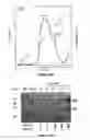 Fig. 17 - Antibodies Directed Against Hepatitis C Virus E1E2 Complex, Compositions of HCV Particles, and Pharmaceutical Compositions